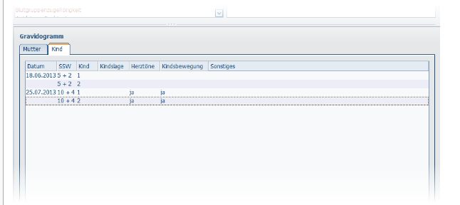 clipboard_e0a479aa076c51454c60684926e538b4a.png